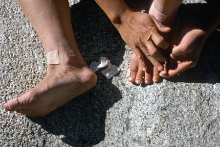 Blisters
High Sierra, California